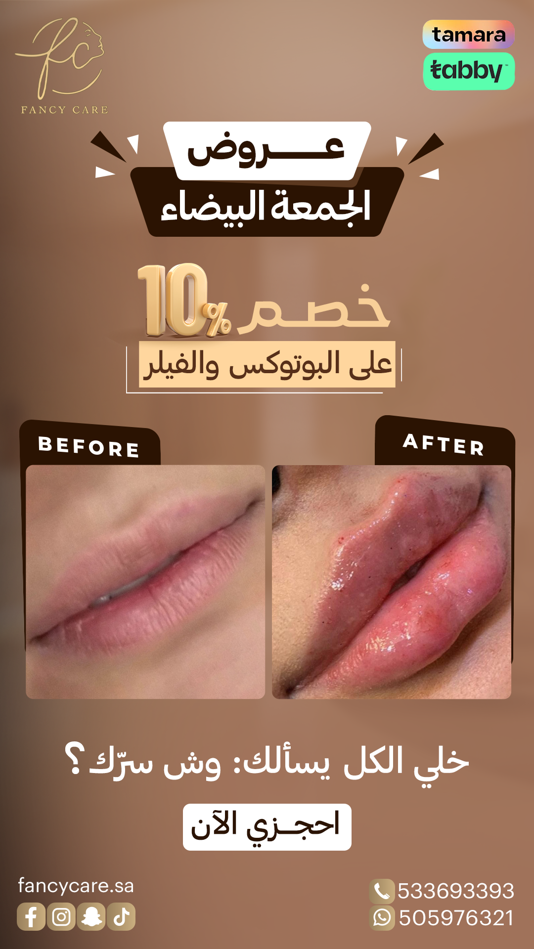 العرض الرئيسي