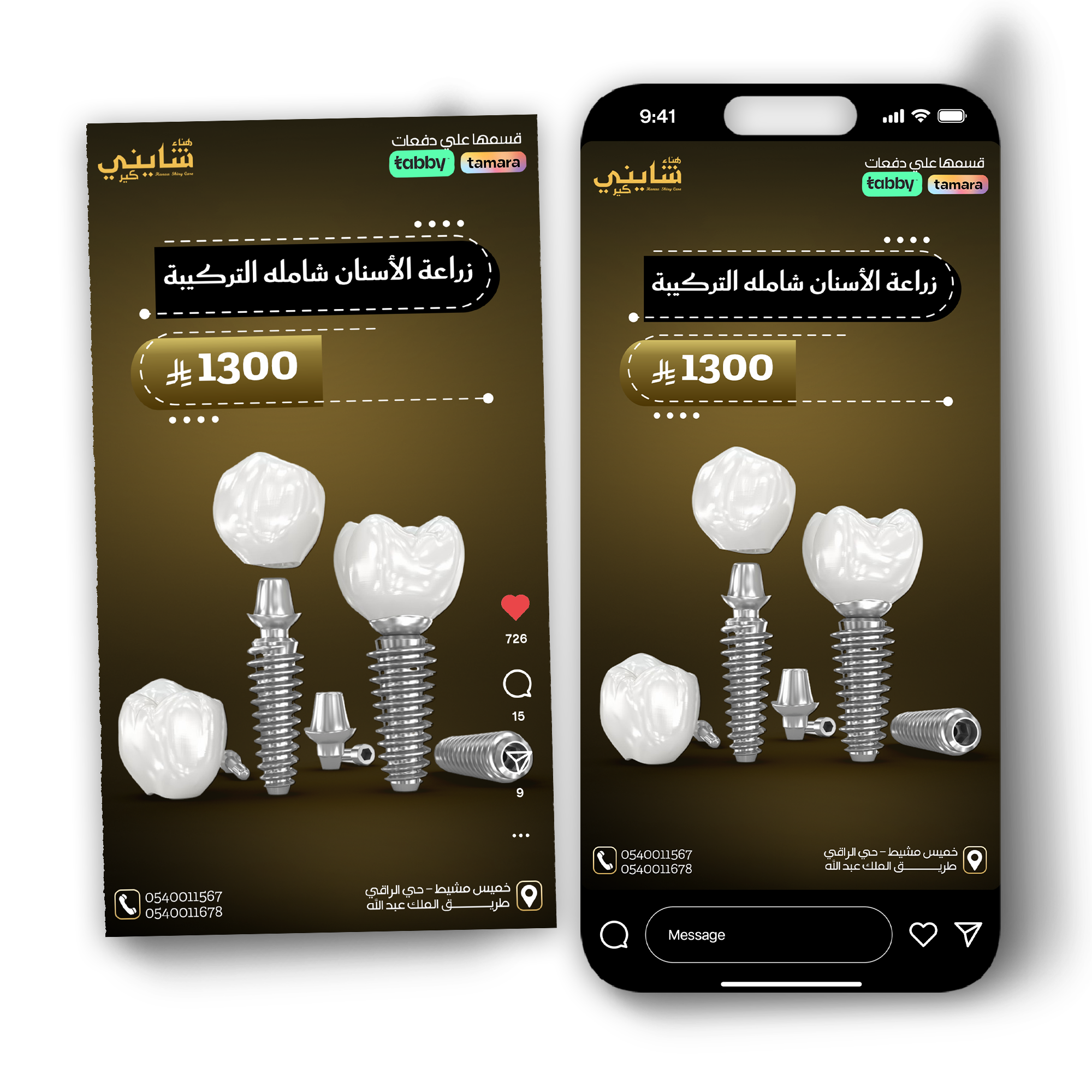 تصميم أسنان 3