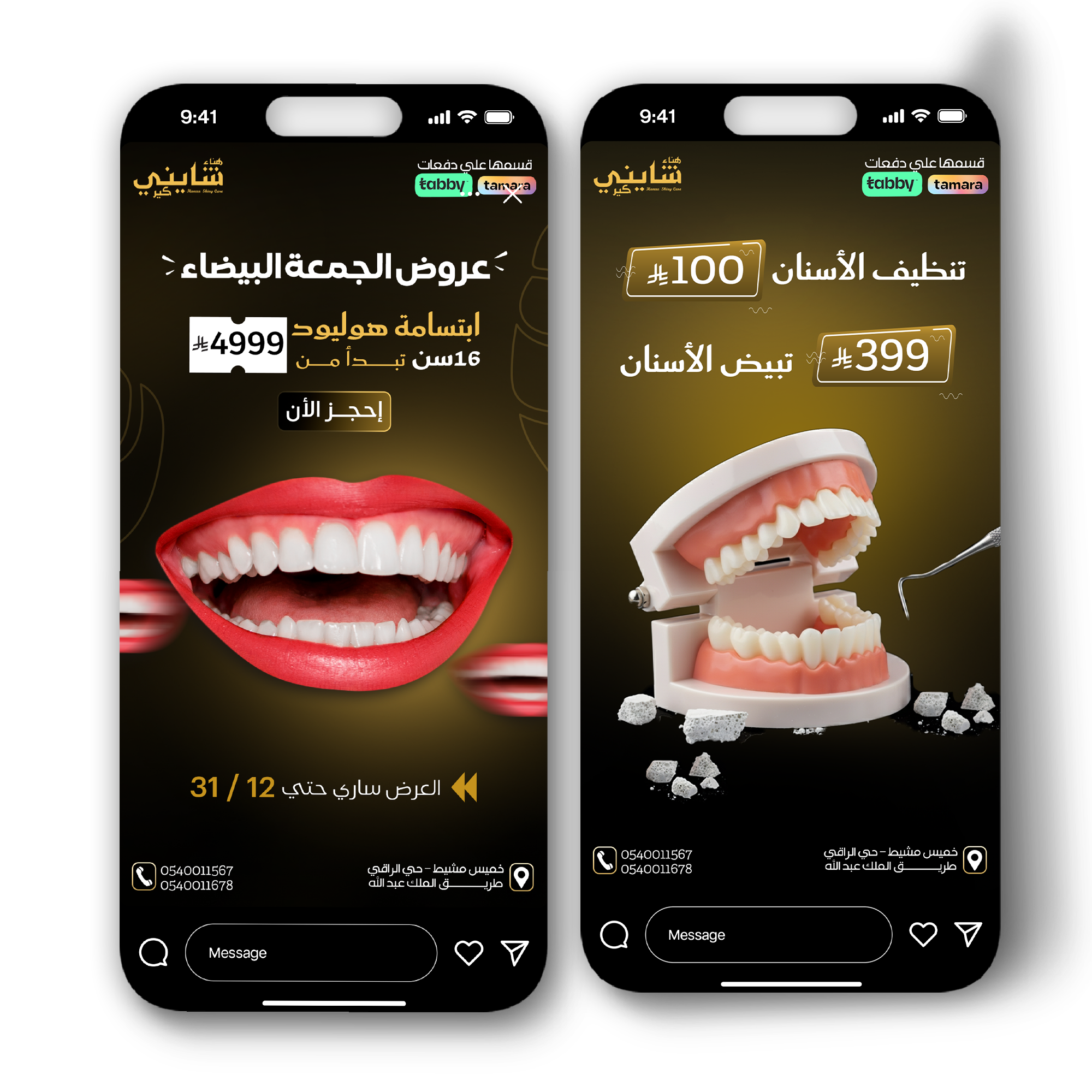 تصميم أسنان 4